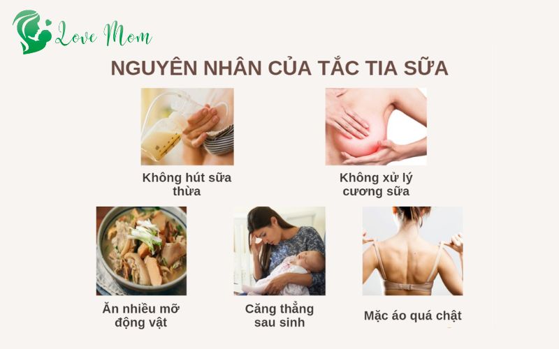 Nguyên nhân dẫn đến tắc tia sữa 