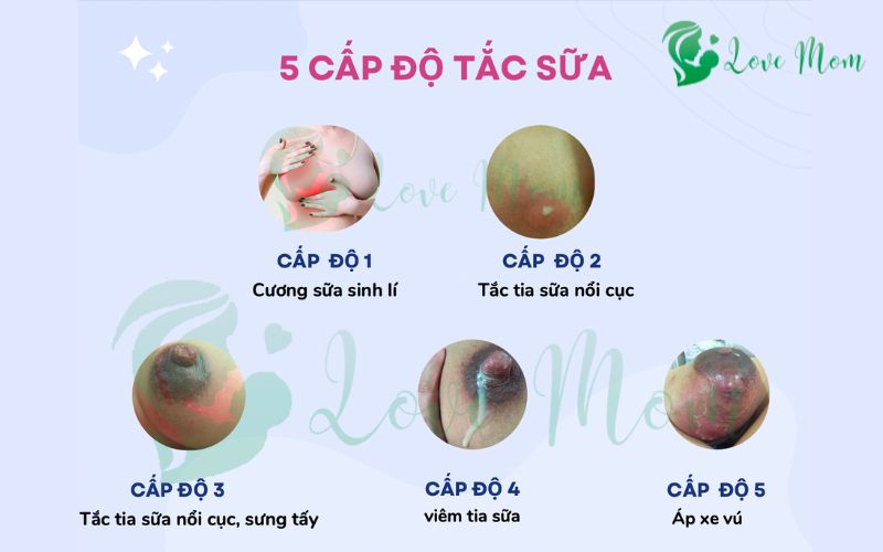 So-do-5-cap-do-thong-tac-sua