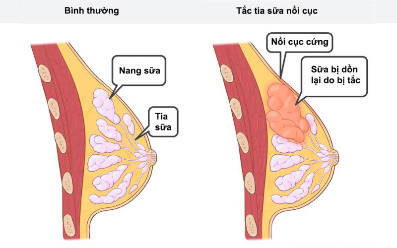 chua-tac-tuyen-sua